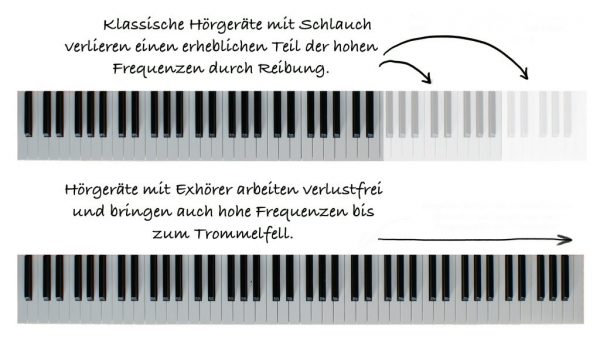 Die Tastatur eines Klaviers macht das Übertragungsverhalten verschiedener Hörgeräte deutlich.